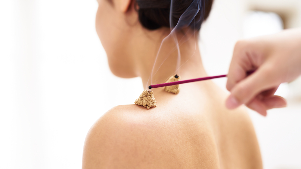 Moxibustion